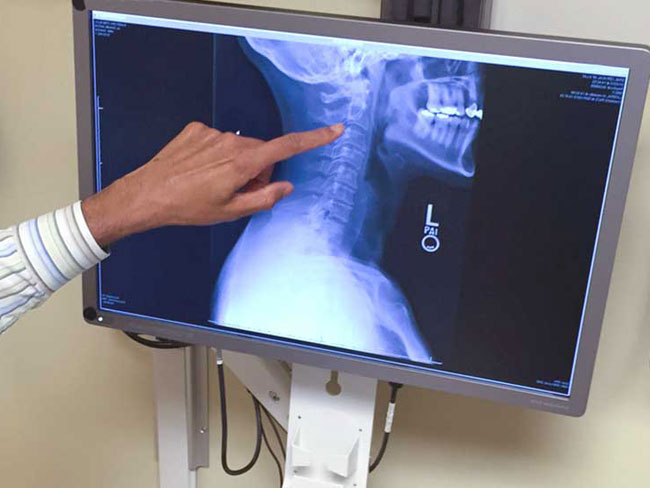 Gutartige Striktur der Speiseröhre Ursachen, Symptome Diagnose