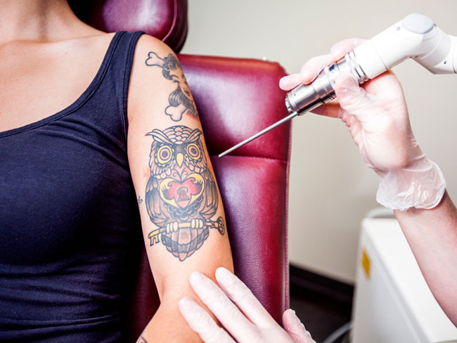 Tattoo Infektion Symptome und Behandlung